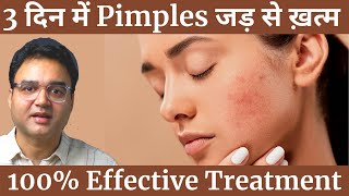 Pimples को बोलो अलविदा  4 Simple Steps To Remove Pimples amp Get Clear Spotless Skin Naturally [upl. by Atillertse616]