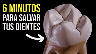 ¿Cómo salvar tus dientes de la caries más peligrosa En 6 minutos te explico [upl. by Eissolf176]