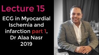 ECG from A to Z 015Alaa nasr2019myocardial ischemia and infarction part 1 [upl. by Jeremy]