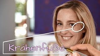 Botox Augenfalten Krähenfüße – Video Dr Günther – Experte für Botox Hyaluron und Laser [upl. by Zoubek]