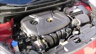 How To Fix Hyundai Elantra Engine Ticking Noise VERY EASY [upl. by Hcirdla]