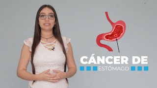 ¡CUIDADO 12 SÍNTOMAS QUE REVELAN CÁNCER GÁSTRICO [upl. by Tohcnarf111]