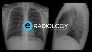 Cómo identificar las PROYECCIONES BÁSICAS de la RADIOGRAFÍA DE TÓRAX 🩻 [upl. by Holzman90]