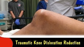 Traumatic Knee Dislocation ReductionQuick Version [upl. by Monson]