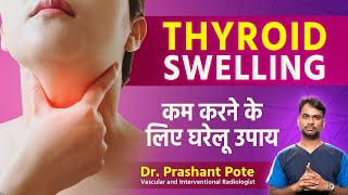 Managing Thyroid Swelling Naturally Diet Exercise and Stress Relief by Dr Prashant Pote [upl. by Swithin]