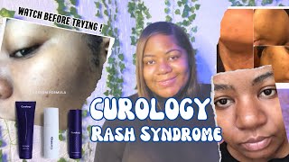 Curology Update Review An Honest Review and My Personal Experience [upl. by Ahsinam917]