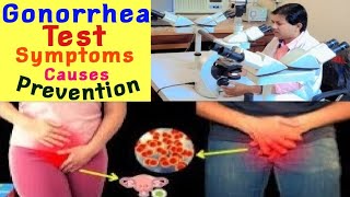 Gonorrhea गोनोरिया रोग फैलाने वाले बैक्टीरिया एवं जांच और लक्षण और बचाव ब्लॉग [upl. by Nimajeb]