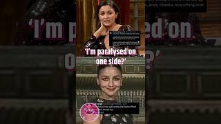 Why so angry Alia Bhatt on BOTOX  shorts trending aliabhatt [upl. by Alexandria]