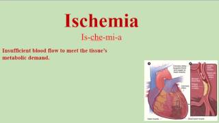 Ischemia Pronunciation and Definition  How to pronounce Ischemia [upl. by O'Gowan]