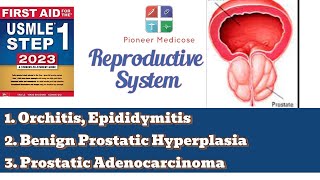 USMLE step 1 Epidimitis orchitis and BPH from First Aid Reproductive system pathUrduHindi [upl. by Paley]