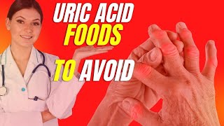 10 Uric Acid Foods to Avoid  Worst Uric Acid Foods for GOUT Attacks  2023 [upl. by Ennaeiluj781]