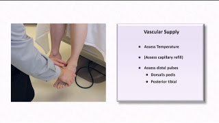 The Diabetic Foot Exam [upl. by Caro]