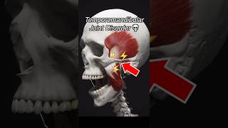 Temporomandibular Joint Dysfunction TMJ  TMD [upl. by Campy]