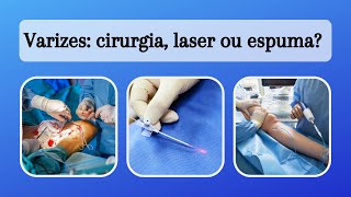 Varizes  cirurgia laser ou espuma [upl. by Eninnej]