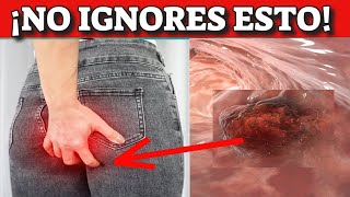 Cáncer de Estómago  ¿Cómo se Forma [upl. by Aziul]