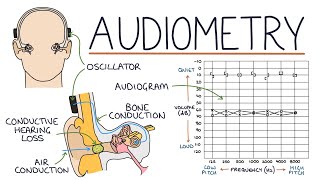 Understanding Audiometry and Audiograms [upl. by Anirbed]