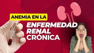 Anemia en enfermedad renal cronica causas y tratamiento [upl. by Ysirhc]