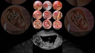 Fetal Development Month by Month😍 [upl. by Hueston]