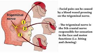 Cerebrum Myofascial Release Complements Neuro Rehabilitation [upl. by Agnew]