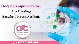 Oocyte Cryopreservation  Benefits Process Age limit and Everything You Need to Know [upl. by Akenn]