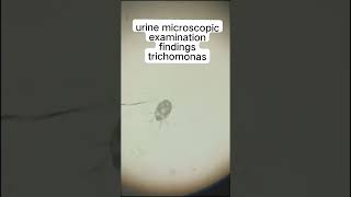 URINE MICROSCOPIC EXAMINATION finding trichimonus🙄 [upl. by Ymiaj122]