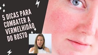 5 DICAS PARA COMBATER A VERMELHIDÃƒO DO ROSTO  Dra Cinthia Orasmo Dermatologista [upl. by Homovec708]