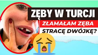 ZŁAMAŁAM ZĘBA  NAJGORZEJ BO GÓRNA DWÓJKA  ROBIĆ ZĘBY W TURCJI🤕 CENA WIZYTY W KLINICE 😢 [upl. by Hermann]