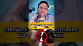 CUIDADO os perigos do MINOXIDIL ORAL [upl. by Filberte741]