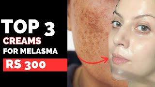 The Best 3 Creams For Rs 300 To Treat Melasma [upl. by Ezechiel373]