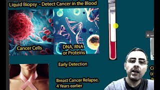 Revolutionizing Cancer Detection Liquid Biopsy Spotting Cancer 4 Years Early [upl. by Grefer]