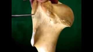 شرح عظمة ال humerus [upl. by Harrat]