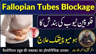 Fallopian tubes blockage and homeopathic treatment  فلوپین ٹیوب کی بند ش  Infertility Dr Waqar [upl. by Sjoberg61]