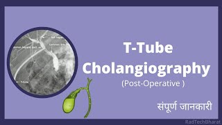 TTube Cholangiography Radiology in Hindi [upl. by Anirtek604]