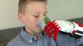 Guido 9 heeft een hand uit de 3Dprinter [upl. by Jedediah]