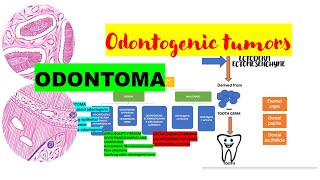 Odontoma DETAILED  Histopath DIAGRAMSComplex vs Compound odontoma  Tumors of odontogenic origiN [upl. by Jarlen]