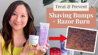 Minimize and Prevent Shaving Bumps amp Razor Burn  Dr Jenny Liu [upl. by Neeroc174]