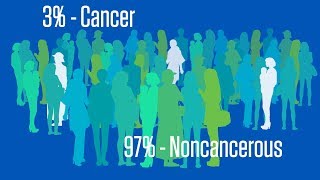 Understanding CA125 Screening for Ovarian Cancer [upl. by Jennifer278]