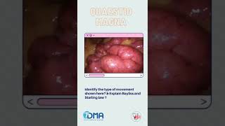 Intestinal peristalsis  OSPE amp OSCE  MBBS  NEXT  PLAB  USMLE [upl. by Brenner]