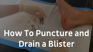 How To Puncture And Drain A Blister  Blister Treatment [upl. by Ehud]