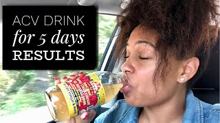 Lose Weight Fast with APPLE CIDER VINEGAR [upl. by Rehtul481]