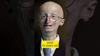 The evolution of Sam Berns [upl. by Della252]