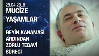 Beyin kanamasının ardından yaşam savaşı veren hastanın tedavi süreci  Mucize Yaşamlar 28042018 [upl. by Eessej]