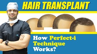 Medlinks Perfect i Hair Transplant Technique  Best Hair Transplant Technique  Dr Gaurang Krishna [upl. by Anayit953]