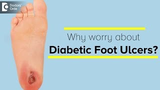 Diabetic Foot Ulcers amp its Management  Dr Sanjay Sharma  Doctors Circle [upl. by Donell]