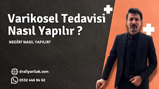 Varikosel Tedavisi Nasıl Yapılır [upl. by Anam]