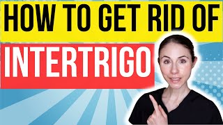 How To Get Rid Of Intertrigo FAST  Dermatologist Tips [upl. by Earised]