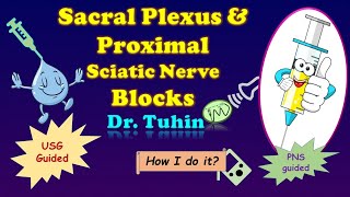 Sciatic Nerve Block  Proximal Approach  Distal Approach  PNS  IDRA  Ultrasound  DrTuhinM [upl. by Alacim]