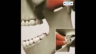 Articulação temporomandibular ATM  DTM  FONOVIM Fonoaudiologia Neurológica [upl. by Otrevogir]