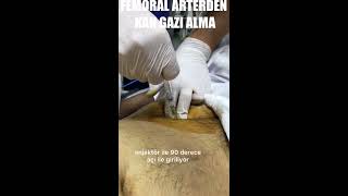 FEMORAL ARTERDEN KAN GAZI ALMANIN PRATİK YÖNTEMİ [upl. by Newlin]