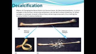 Decalcification of bone [upl. by Maillliw]